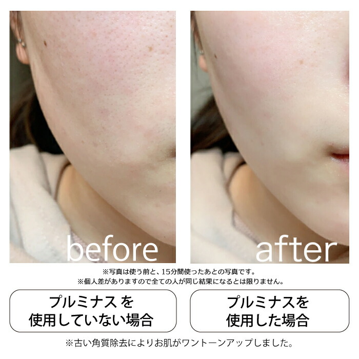 楽天市場】公式 丸洗い出来る美顔器 mous.PLUMINUS プルミナス 防水 超