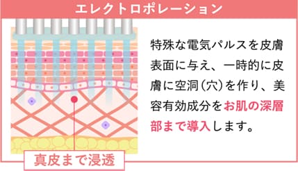 エレクトロポレーション（イオン導入）｜美容皮膚科なら湘南美容