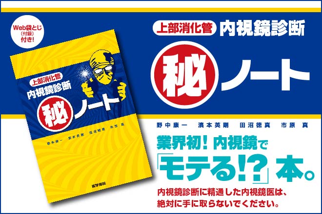 上部消化管 内視鏡診断 マル秘ノート」｜gastropedia（ガストロ