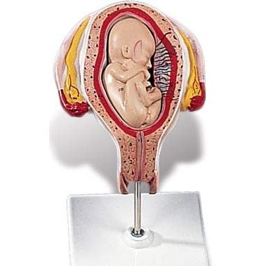 3B社 人体模型 妊娠・胎児模型 妊娠5ヶ月の子宮モデル(骨盤位) （l10-5