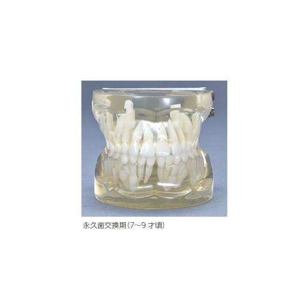 透明乳歯 永久歯交換期模型 永久歯交換期(7〜9歳頃) : 歯科医院専売品
