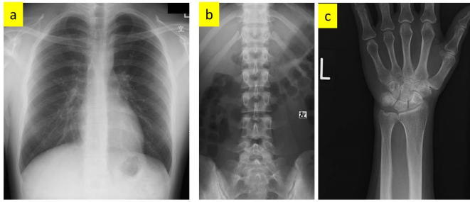 一般撮影(レントゲン検査) - 医療法人桜菜会 まろクリニック