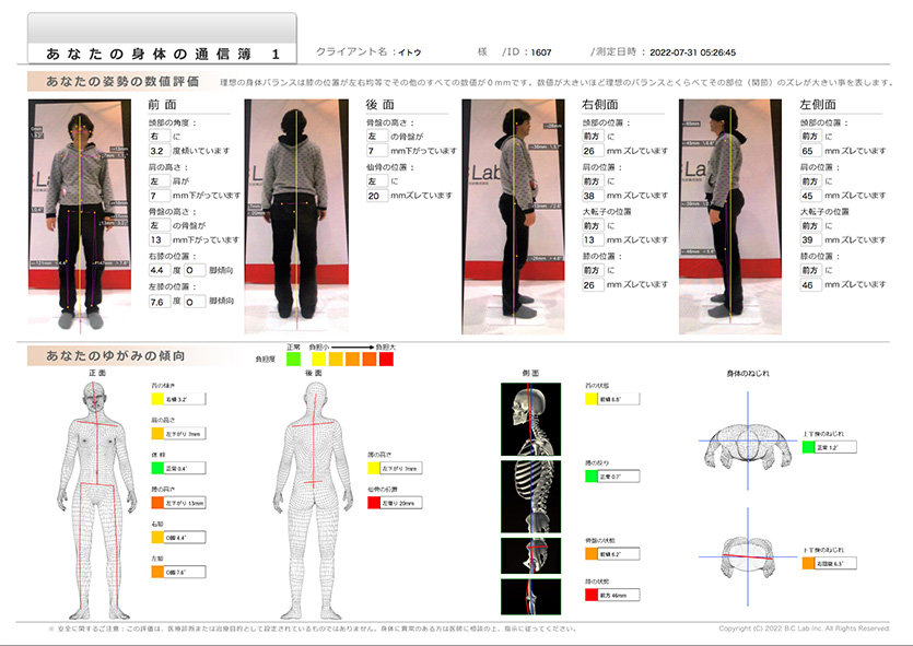 ゆがみーる lite ゆがみーる LITE 姿勢分析