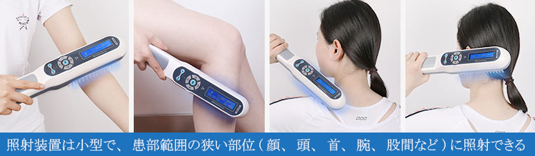 家庭用（ナローバンドUVB311＆エキシマライト308）紫外線治療器[個人