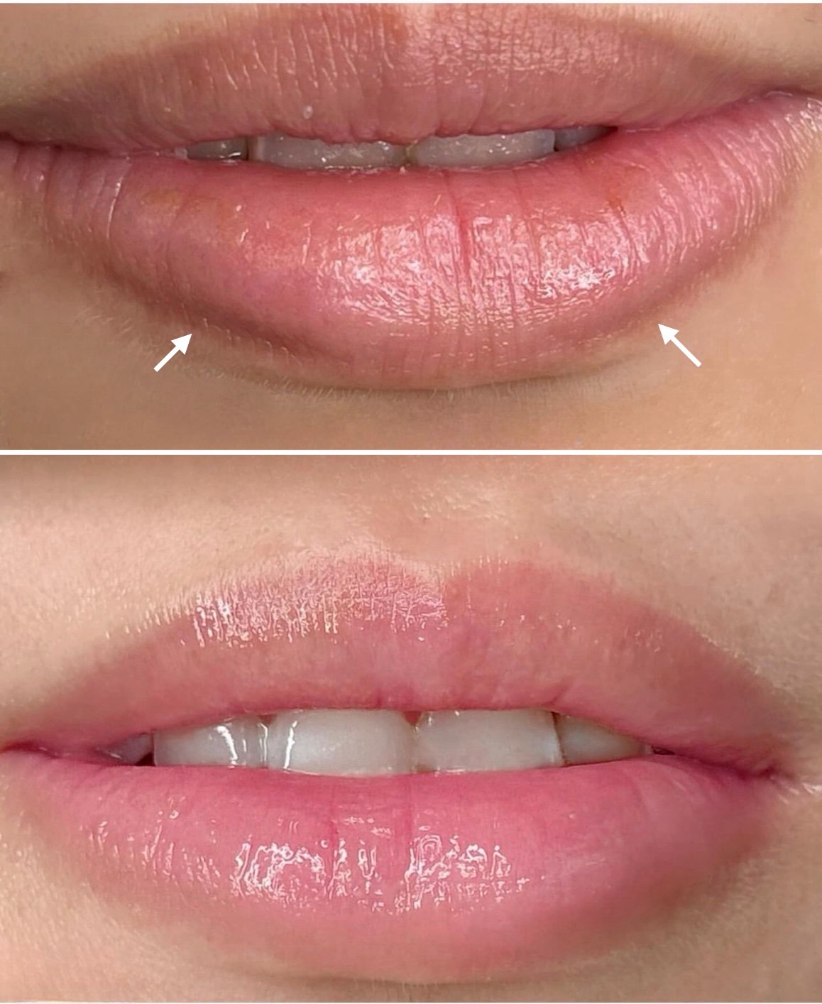 ローマピンク| 美容外科SOL CLINIC