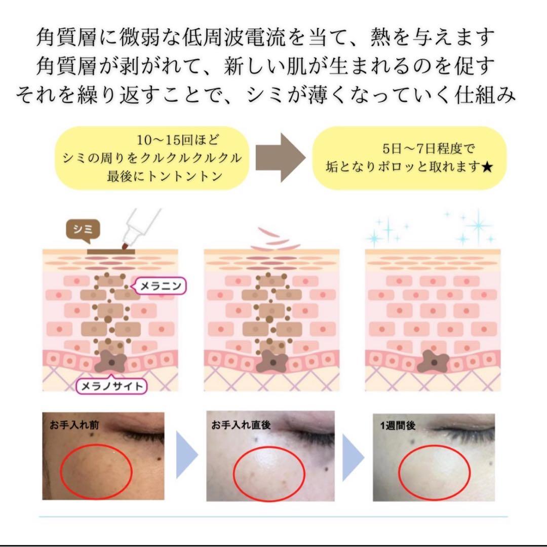 低周波ペンシル シミケア機 リシルク ReSilk セット販売 - メルカリ