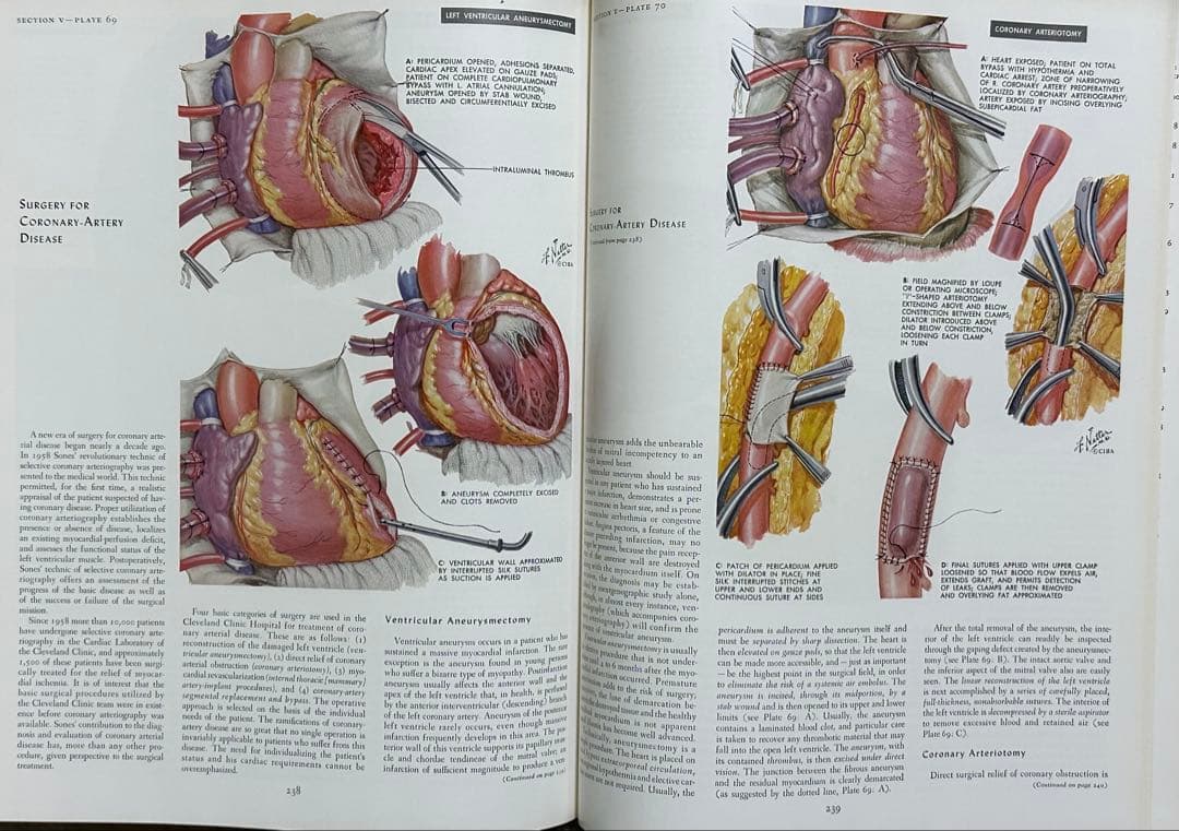 CIBA医学イラスト集 1、2、3(1-2-3)、4、5 /フランクH.ネッター - メルカリ