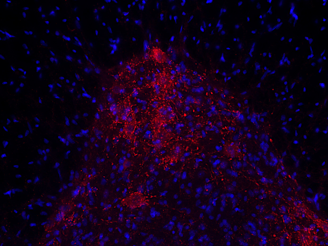 Synaptic Systems - VAChT